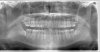 teeth-scan.jpg