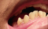 teeth borders.png