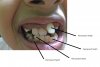 sulaim-teeth.jpg
