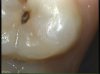tooth 3.jpg