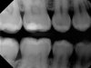 tooth 4.jpg