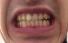 teeth.png