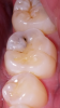 the_molar.png