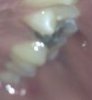 tooth.jpg