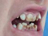 IMG_20170309_081826.jpg IMG_20170309_081826.jpg