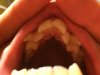 teeth1.jpg