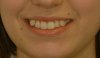 Frontal smile close up.jpg