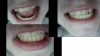 teeth.png teeth.png