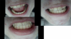 teeth.png