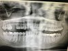 XRAY DENTAL 2.jpg