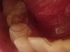 tooth 3-28-18 #2.jpg