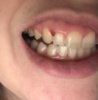 tooth2.jpg