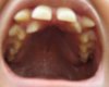 Teeth2.JPG