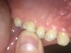 tooth.JPG