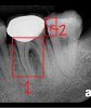 Molar_19.jpg