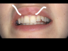 537B3236-227C-4D5F-AD43-A3201CAF8D78.png 537B3236-227C-4D5F-AD43-A3201CAF8D78.png
