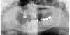 dental xray 191115.jpg