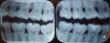 xray-recent.jpg xray-recent.jpg