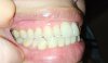 mouth.jpg mouth.jpg