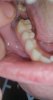 tooth 2.jpg