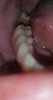 tooth 3.jpg