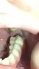 tooth 4.jpg