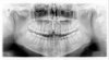 Dental X-ray.JPG