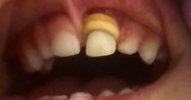 Dental-Message-Board_No-Idea-What-This-Is_48885.jpg Dental-Message-Board_No-Idea-What-This-Is_48885.jpg