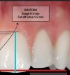 Central lateral and canine lengths.jpg