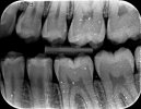 X-ray 1.jpg