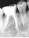 Dental-x rays- image_.jpg
