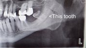 Peter Duffy teeth x-ray DSC_0001 copy.JPG