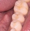 tooth.jpg