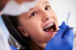 girl-with-braces-during-routine-dental-examination.jpg