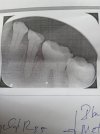 teeth_x_ray.jpg