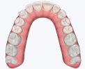 teeth upper aft.png