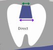 Direct (comp or amalg).JPG