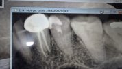 20250325_093850.jpg