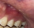 gum issue 2.jpg