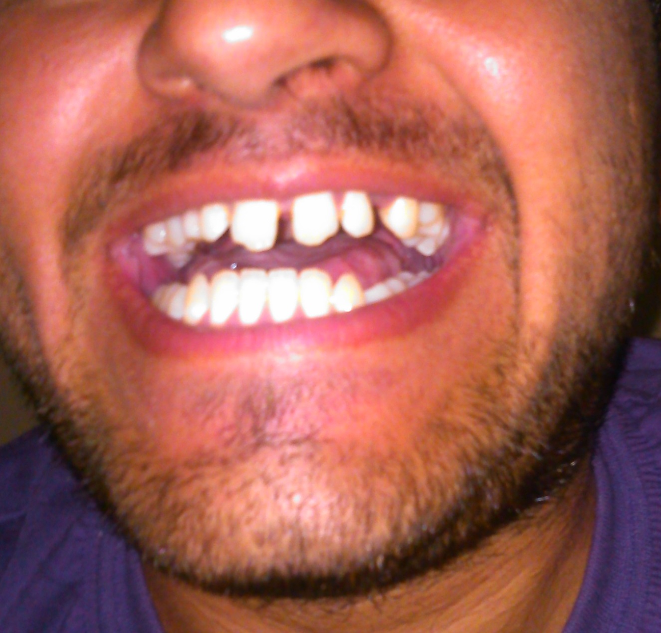 W9BMXF4.jpg