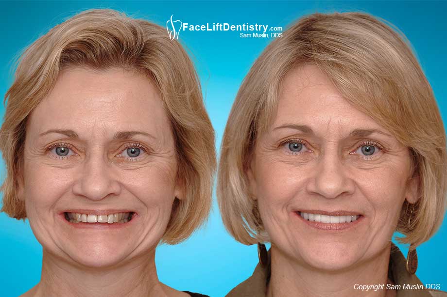 www.faceliftdentistry.com